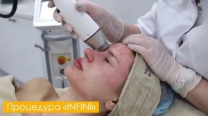 Фракционный микроигольчатый RF лифтинг на INFINI