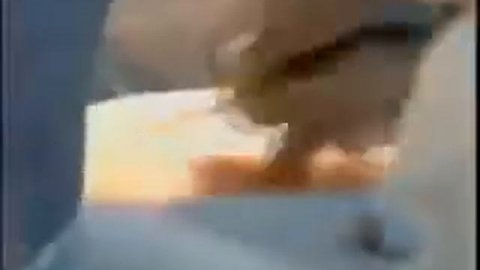 Липосакция спины - пластический хирург Блохин С.Н.