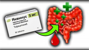 Прорыв в Лечении Язвенного Колита! Тофацитиниб ЯКВИНУС