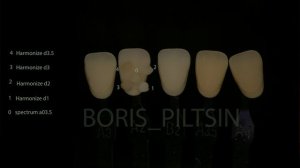 Композиты. Где правда, а где вымысел? Ceram x, Asteria, Harmonize, Реставрин, Escom100, Charizma.