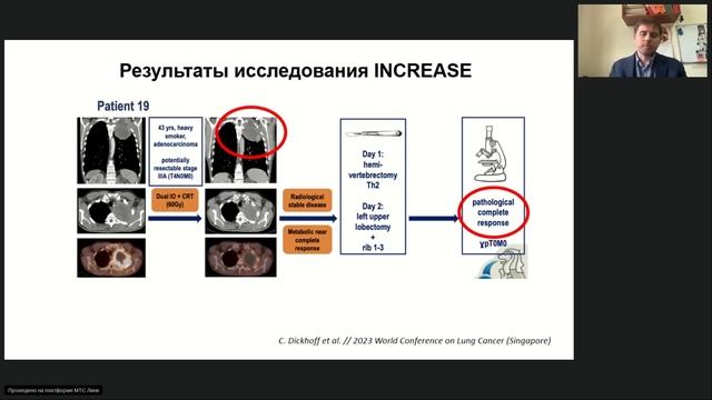 Лучшее по материалам всемирной конференции по раку легкого WCLC 2023 вебинар 26 октября 2023