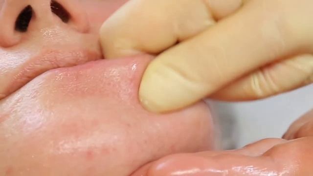 Урок по буккальному массажу