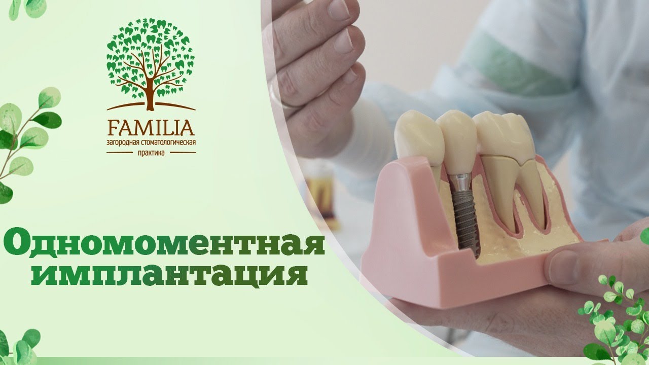 Familia стоматология Краснодар. Стоматологическая практика "familia". ROOTT имплантация.