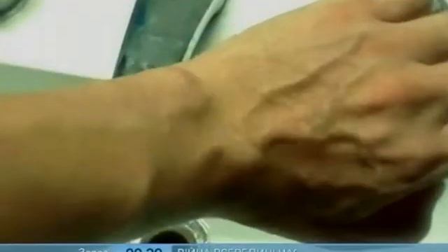 Артрит і Артроз Помолодшали - Ранок - Інтер смотреть онлайн