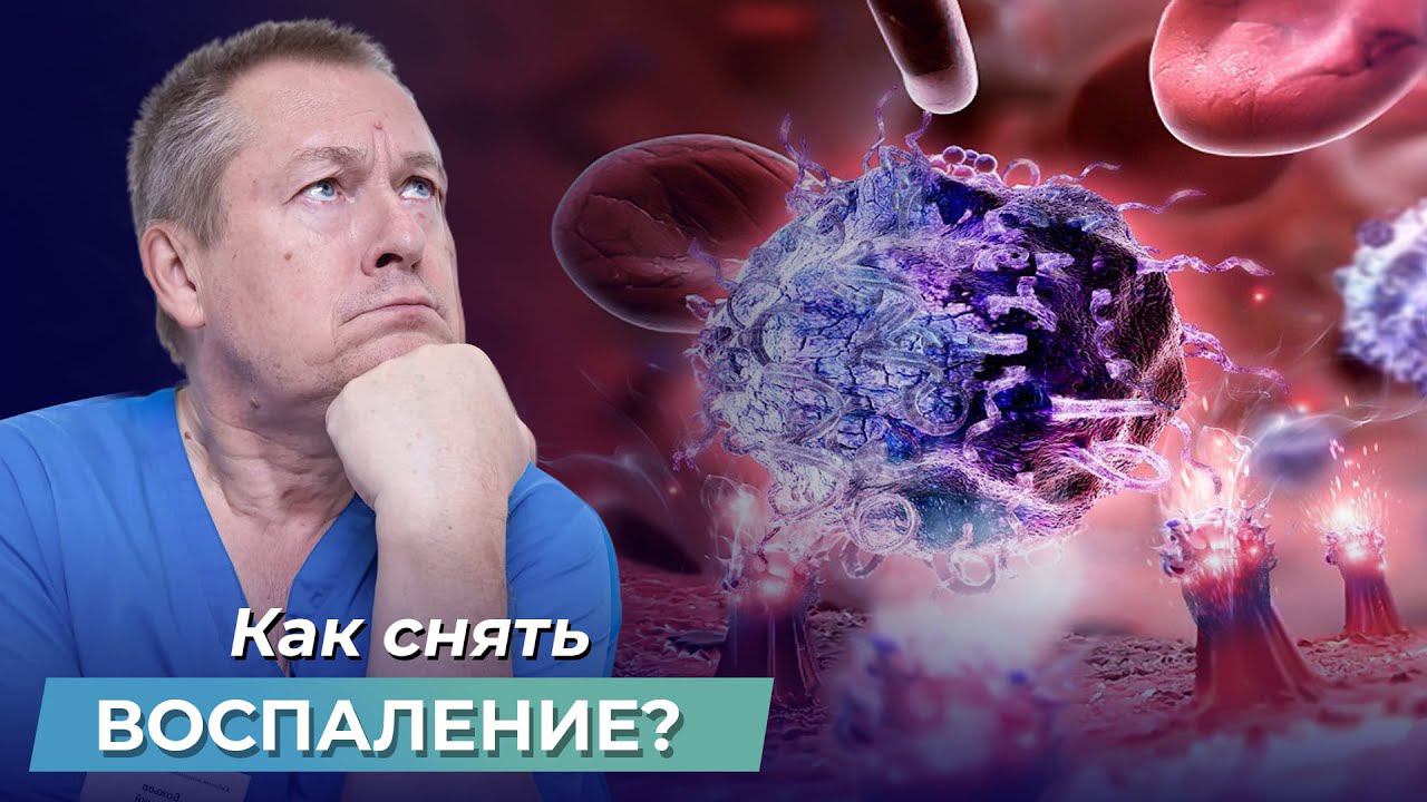Как быстро СНЯТЬ ВОСПАЛЕНИЕ? 5 факторов воспалительной реакции, о которых УМАЛЧИВАЮТ ВРАЧИ!