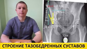 Почему люди приседают по-разному строение тазобедренных суставов Hip joint structure and actions