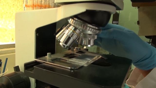 ¿Cómo enfrentar el fusarium oxysporum FOC R4T? смотреть онлайн