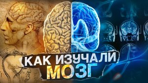 Как устроен мозг? История изучения самого загадочного органа человека