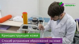 Криодеструкция кожи