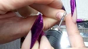 Чистка боковых пазух и валиков фрезой