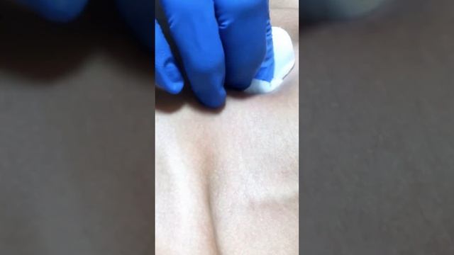 Мои работы . Микродермал установка. #pirsing #пирсинг смотреть онлайн