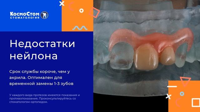 Съемные зубные протезы сравнение смотреть онлайн