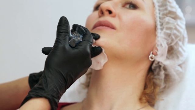 Коррекция подбородка, Углы нижней челюсти, Подтянутый овал лица, Как убрать брыли