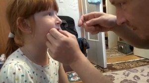 Удаление зуба. Как вырывают молочные зубы.