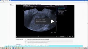 Анализ тестов к лекциям Эхосемиотика структурных изменений органов малого таза Часть 2
