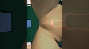 Цистоскопия