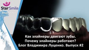 Работают ли элайнеры для выравнивания зубов?