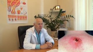 Причины и стадии фурункулеза