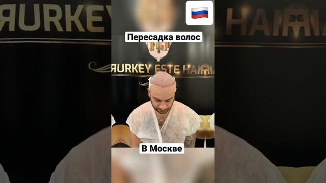 Пересадка волос в Москве #пересадкаволосроссия #пересадкаволос #hairtransplant