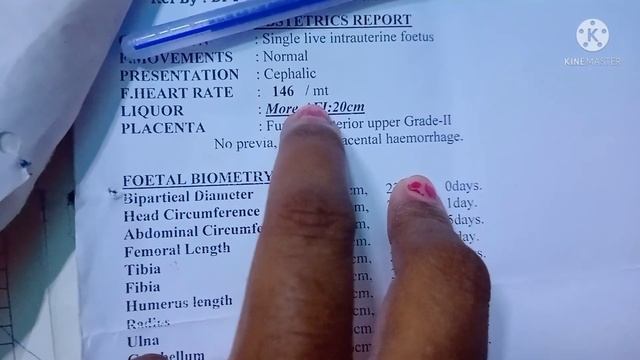 Babyboy6th month tiffa scan reports explain in Telugu|how to read tiffascan reports|Boyscan reports смотреть онлайн