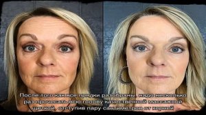 Правила ухода за волосами после ботокса