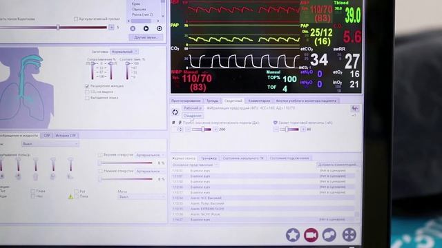 СимМэн 3G - высокотехнологичный робот-симулятор пациента для отработки навыков командной работы смотреть онлайн