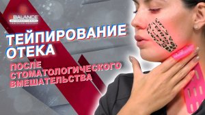 ✅ ТЕЙПИРОВАНИЕ ОТЕКА ПОСЛЕ СТОМАТОЛОГИЧЕСКОГО ВМЕШАТЕЛЬСТВА | Сания Абдрахманова | BBALANCE