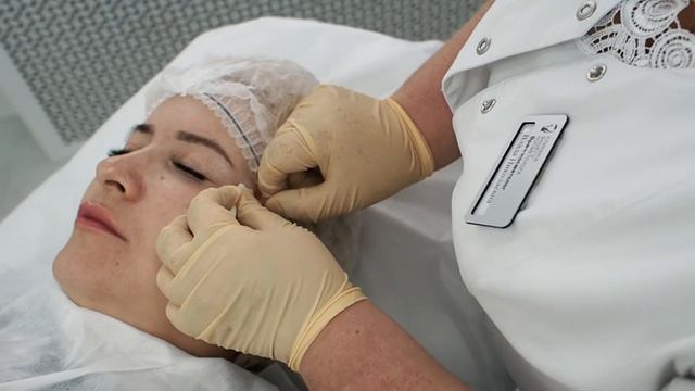 Нитевой лифтинг (Тредлифтинг) - EPIC LOOK смотреть онлайн