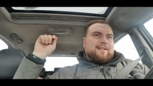 Три года после пересадки волос, не просто Глеб.