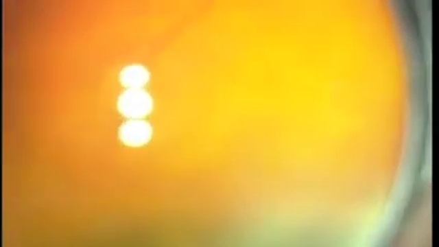 Авастин в интернет аптеке Wer.ru смотреть онлайн