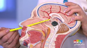 Правда жизни: удаление опухоли мозга. Жить здорово! Фрагмент выпуска от 31.01.2020