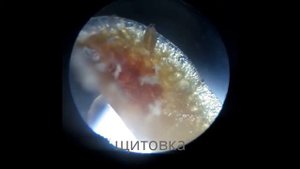 щитовка через микроскоп, июль 2016 год