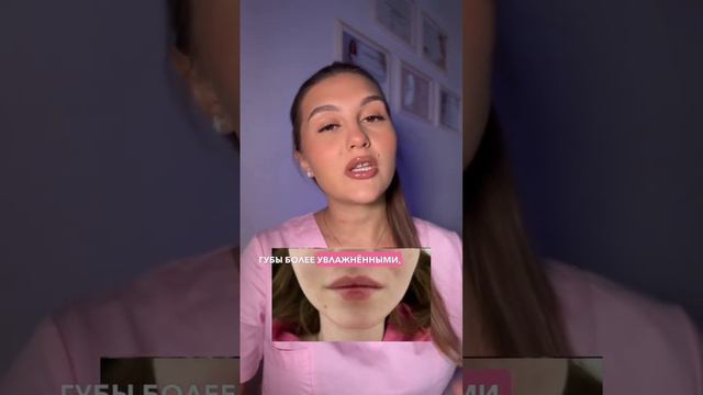 Как выглядит 0,5 мл и 1 мл в  губах? смотреть онлайн