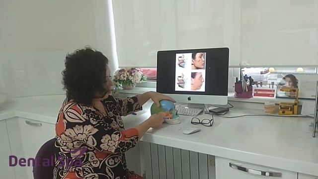 Почему при установке брекетов ухудшается эстетика лица