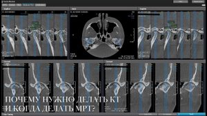 Почему для консультации нужно делать КТ, и когда нужно делать МРТ?