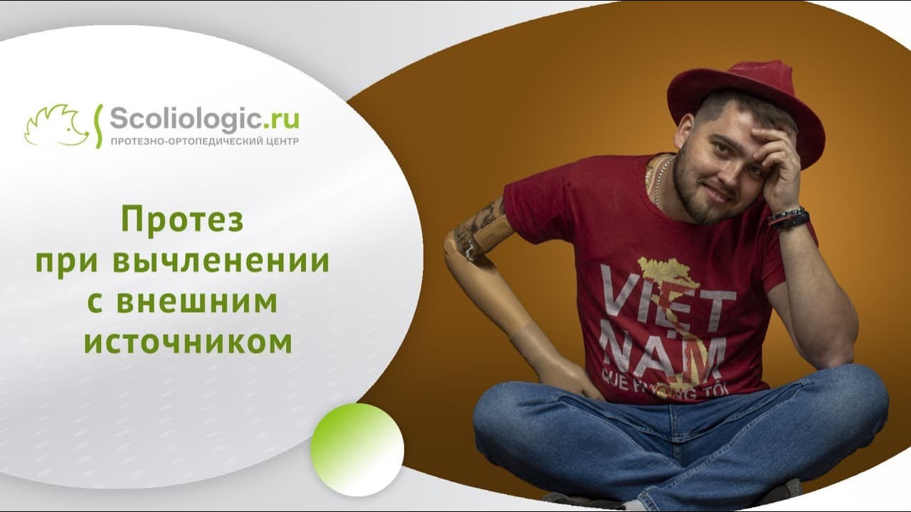 Протез на вычленение с внешним источником энергии - сложный протез