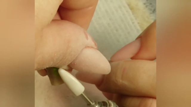 Выстригаю вырваный ноготь смотреть онлайн