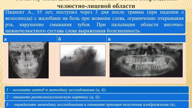 Занятие № 6 Ситуационные задачи Лучевая диагностика травм челюстно лицевой области смотреть онлайн