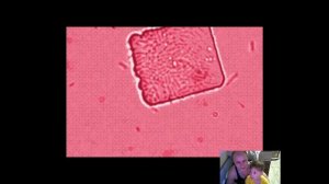 БАКТЕРИИ под микроскопом