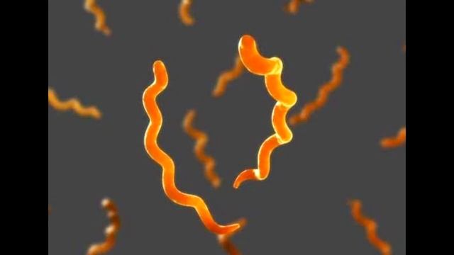 У ВИКИ СИФИЛИС смотреть онлайн