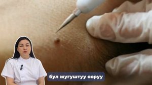 Контагиозный моллюск