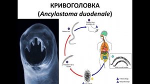 Нематоды - 2
