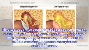 Что делать, если заложило ухо