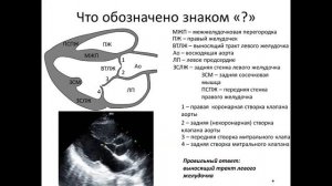 Ультразвуковая анатомия сердца