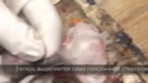 Опыты Матеучи Гальвани