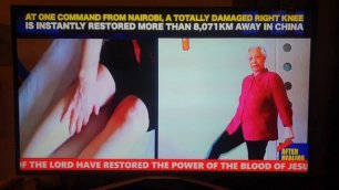 Damaged Right Knee Instantly Healed In China