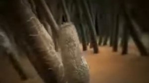 Профилактика педикулеза