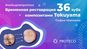 Временная реставрация 36 зуба #proteco #стоматологи #реставрация #зубы