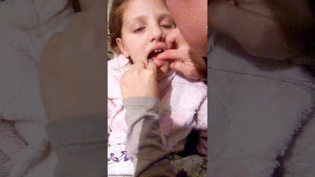 Як правильно виривати зубчики смотреть онлайн