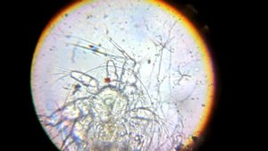 Науплиус циклопа.Микроскоп юннат(объектив ломо 40 0,65)